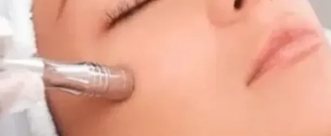 aparotologia estética faical profesional Dermapen médico IT Pharma
