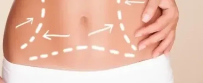 aparotologia para estética faical y corporal diagnóstico y láser Ross